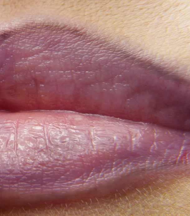 Entfernung Permanent MakeUP Lippen Vorher